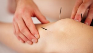 acupuncture-wellington-acc-provider
